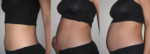 1�5mois