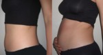 La diff�rence entre le 1er et le 4eme mois